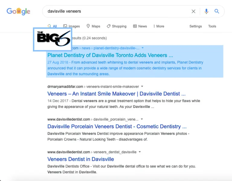 Screenshot of Google search results for davidsville veneers with the top result highlighted in blue, showing a link to Planet Dentistry of Davidsville Toronto and related dental veneer services below.